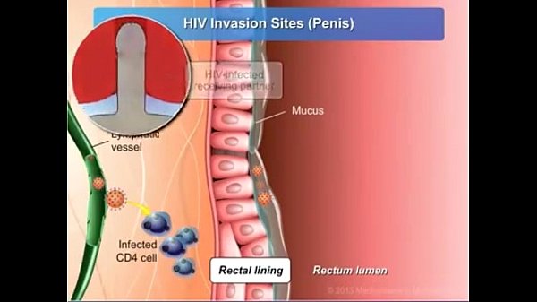 Oral Sex Có Bị Hiv